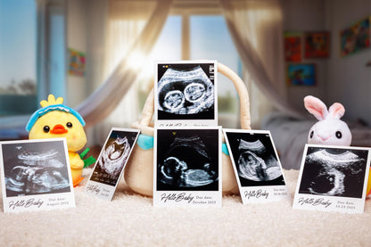 Personalized Ultrasound Photo Magnets