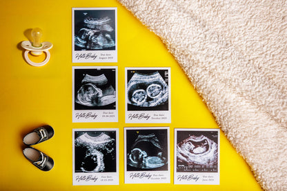Personalized Ultrasound Photo Magnets
