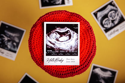 Personalized Ultrasound Photo Magnets