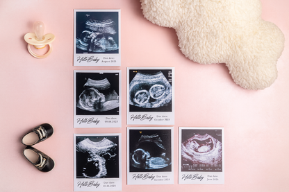 Personalized Ultrasound Photo Magnets