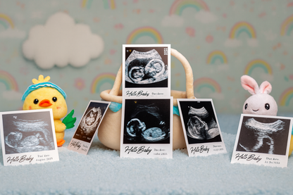 Personalized Ultrasound Photo Magnets