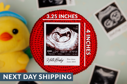 Personalized Ultrasound Photo Magnets